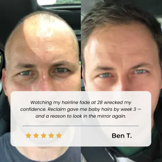 Aparthy Hair Growth Roll on Serum